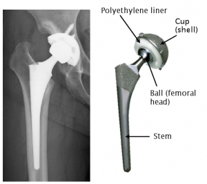 The structure of the artificial hip joint