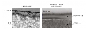 生体の関節軟骨と新しい人工股関節の表面
