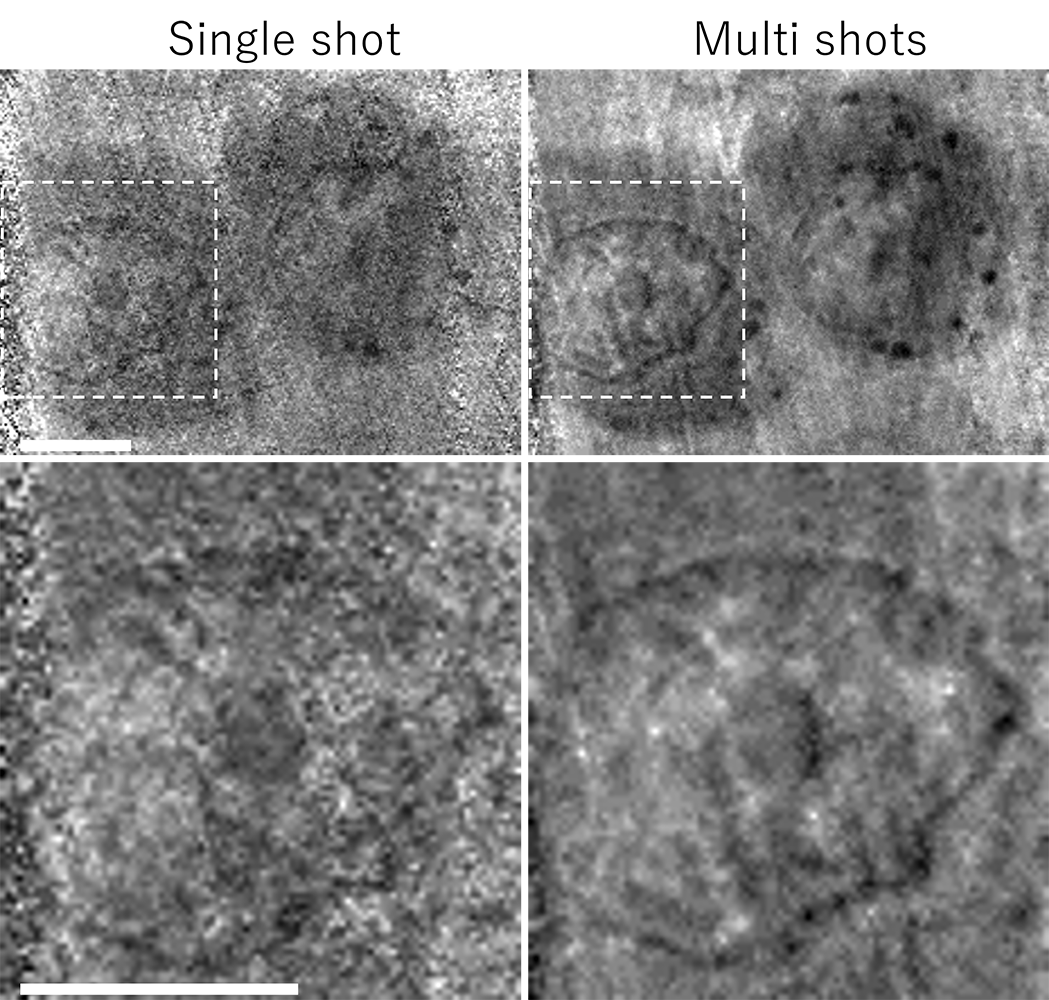 Black and white grainy images of cells taken with a single shot and multiple shots.