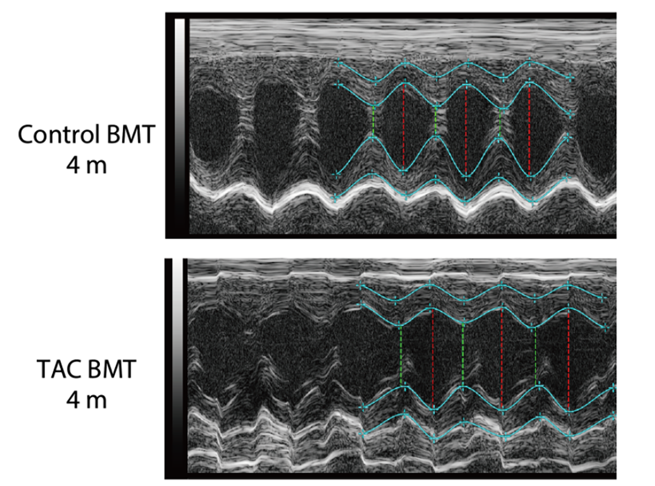 Echocardiogram image showing the difference between a healthy mouse heart and one with heart failure. 