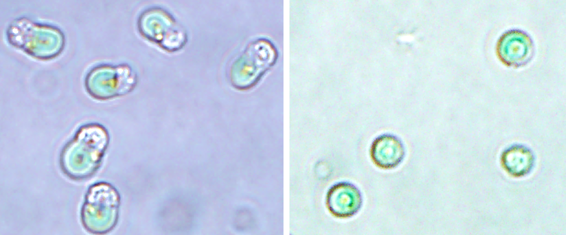 Close-up image of chloroplasts extracted from red algae.