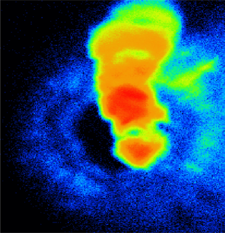 A dark blue background with a red blob surrounded by green