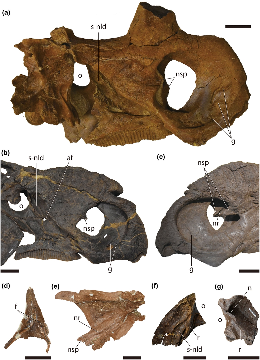 A collection of brown and gray bone fragments