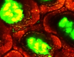 macrophages