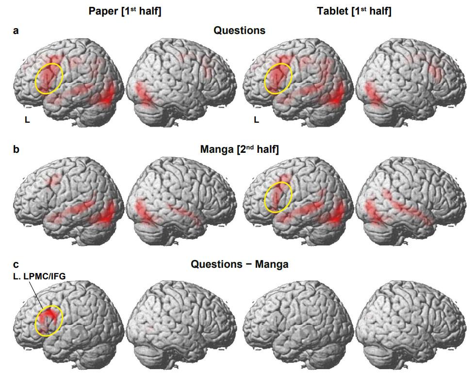 A grid of brains in grey with active areas in red